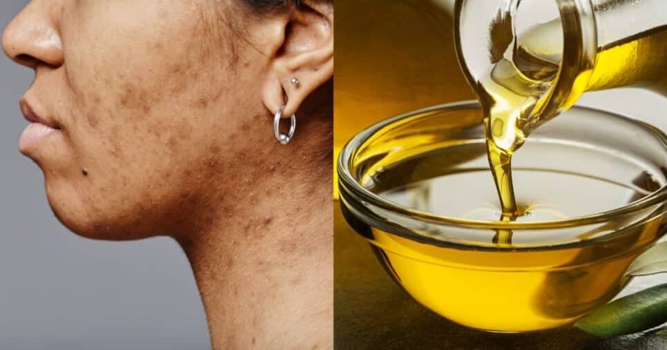Harmonização facial caseira: Mistura natural com 3 ingredientes some com manchas e linhas de expressão