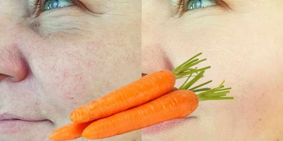 Fim das rugas: Harmonização facial caseira com cenoura e +3 ingredientes traz pele de bebê em minutos