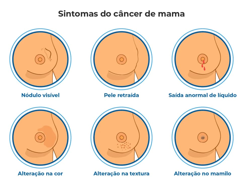 Imagem do post Imagem do post