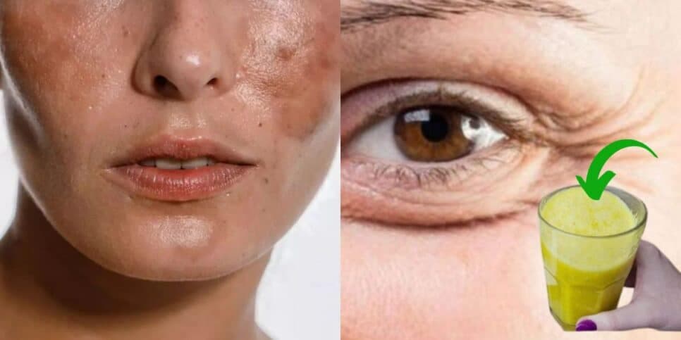 Fim das rugas e manchas na pele: Suco de colágeno com 8 ingredientes pra mulheres 55+ voltarem aos 30