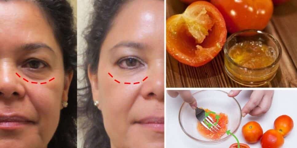 Resultado da aplicação de tomates amassados nas olheiras (Foto Reprodução/Montagem/Pinterest)