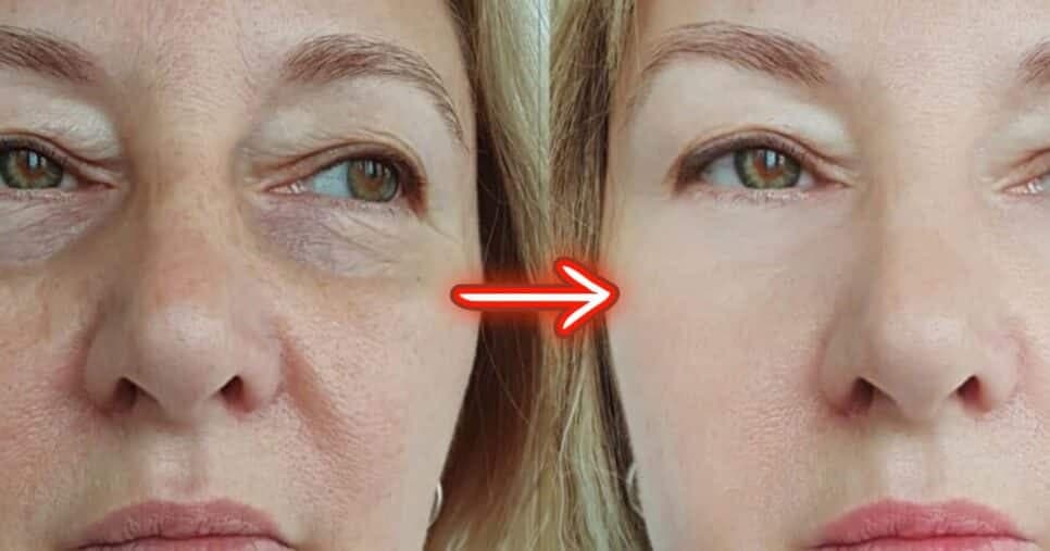 Fim das rugas e manchas: Mistura com 4 ingredientes combate a flacidez da pele e rejuvenesce às 60+