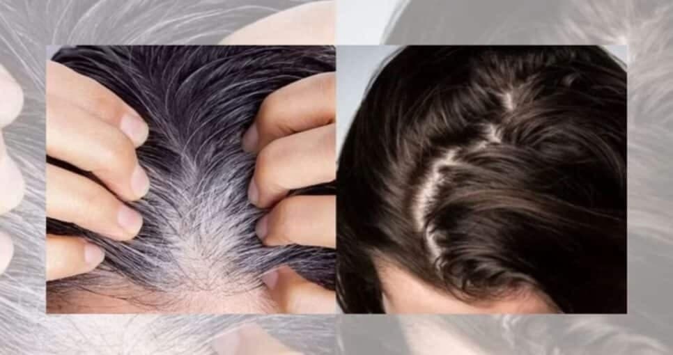 Fim do grisalho sem amônia: Tinta natural acaba com o cabelo branco e ressuscita fios morenos em 3 passos