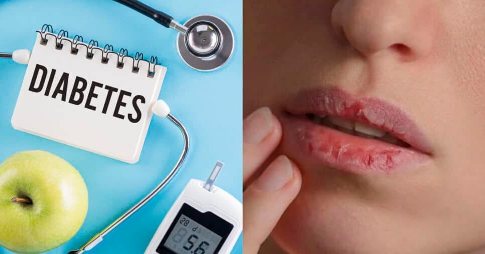 Alerta de diabetes: 7 sinais na boca indicam açúcar no sangue totalmente fora de controle