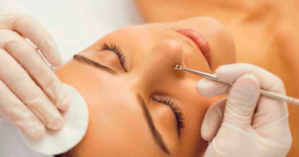Adeus, clínicas de estética: Limpeza de pele com 2 ingredientes remove até o último cravo sem gastar 1 real