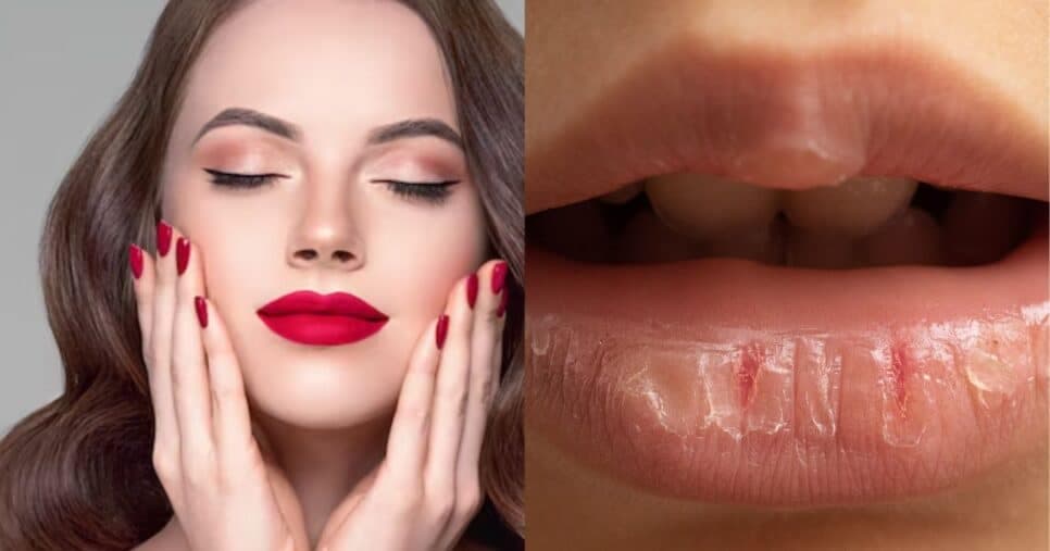 Boca macia: 4 passos + 3 ingredientes naturais para dar fim aos lábios desidratados, rachados e ásperos