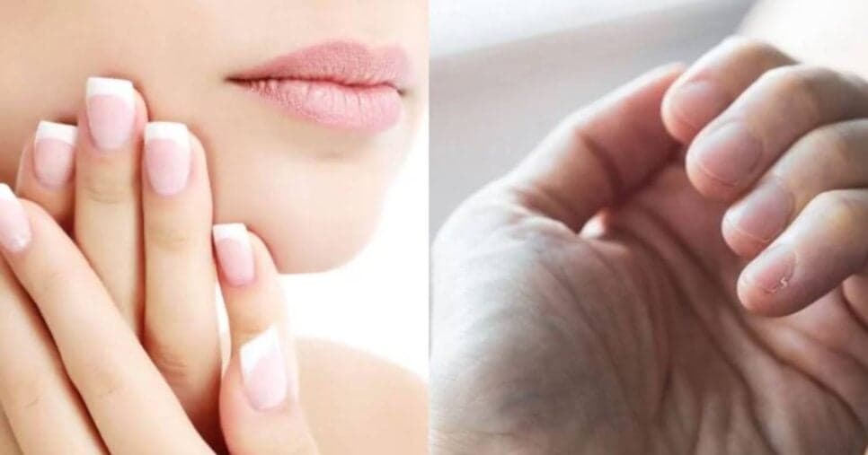 Segredo das manicures: Único ingrediente popular da cozinha deixa unhas inquebráveis e lindas em 15 minutos