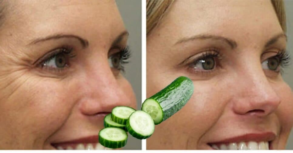 Harmonização facial caseira: Mistura com pepino +4 ingrediente extermina rugas e estica pele de idosas 60+