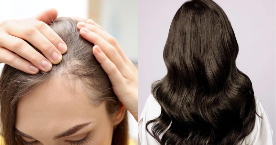 Tchau, perda de fios: 4 truques milagrosos dão fim às falhas no cabelo e renovam a autoestima de mulheres