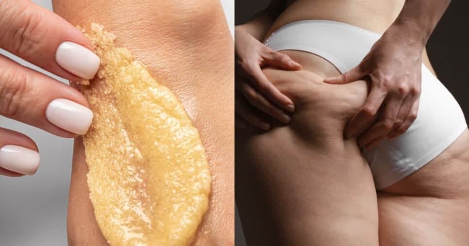 Fim da drenagem: Esfoliação natural com 3 ingredientes dá fim a celulite e deixa perna de mulheres 50+ listinhas