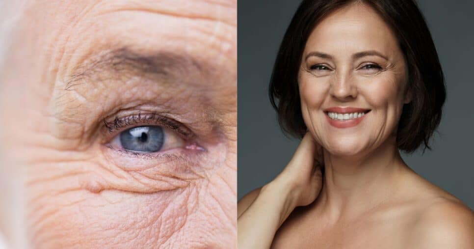 Substituto do botox: Mistura com 2 ingredientes preenche rugas e rejuvenesce mulheres 55+