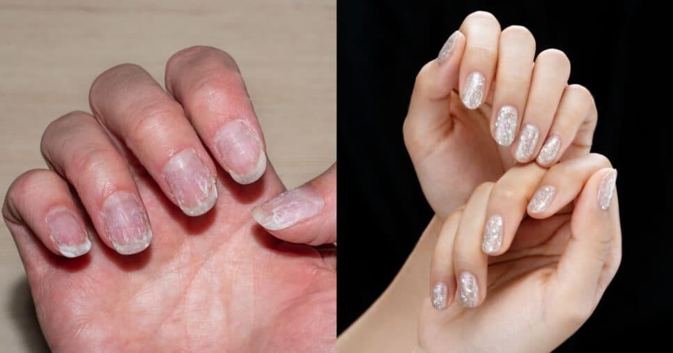 Fim das unhas fracas: Base endurecedora com 3 ingredientes chega pra salvar mulheres em 2025