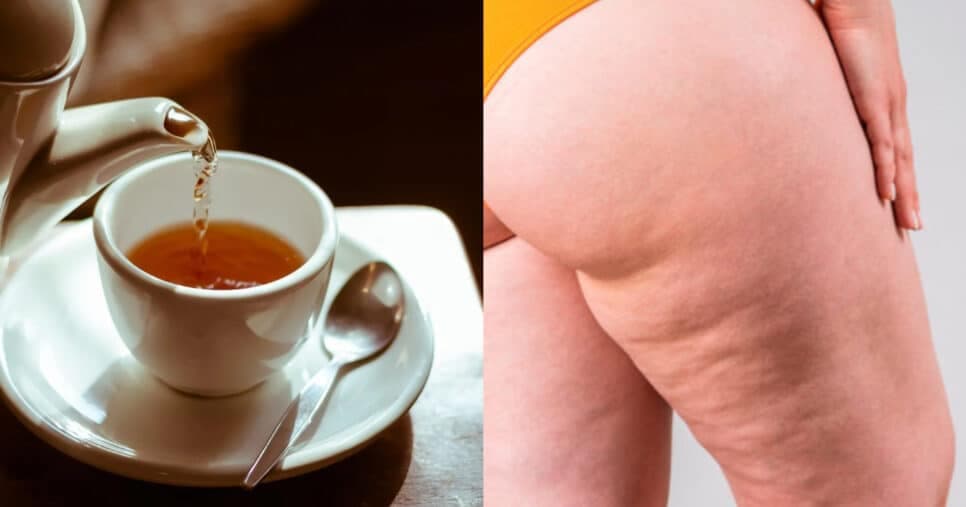 Tchau, celulite e furinhos na perna: Chá INFALÍVEL com ÚNICO ingrediente popular te dá pernas das famosas