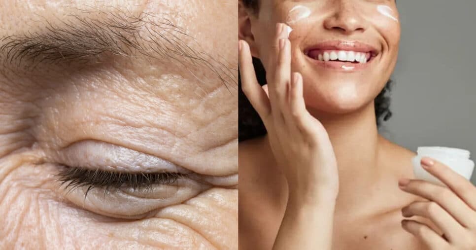 Elixir supremo da juventude: 4 ingredientes populares acabam com às rugas e rejuvenescem às 45+