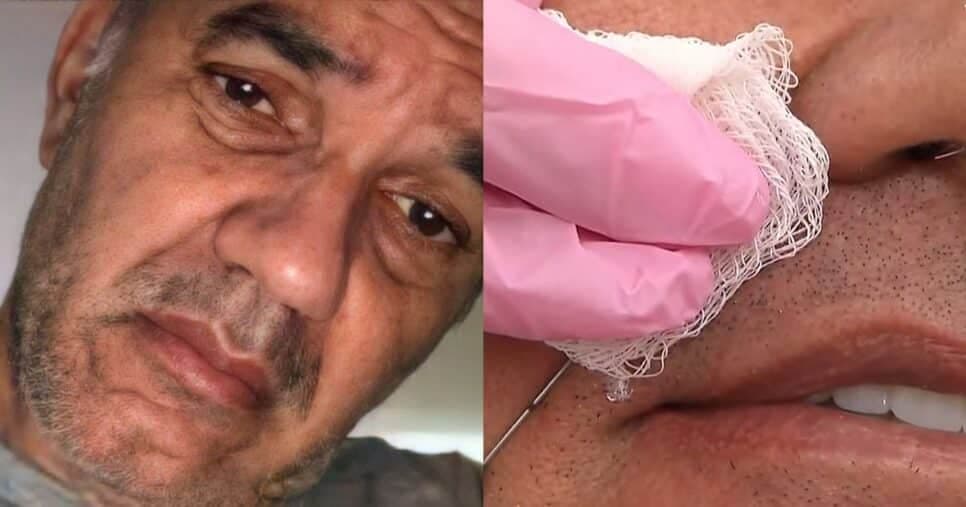 “10 anos mais jovem”: Humberto Martins faz harmonização facial no Fofocalizando e resultado choca público do SBT