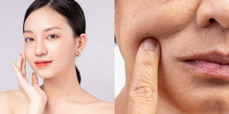 Plástica natural: Máscara japonesa com 3 ingredientes suga rugas profundas e deixa pele lisinha