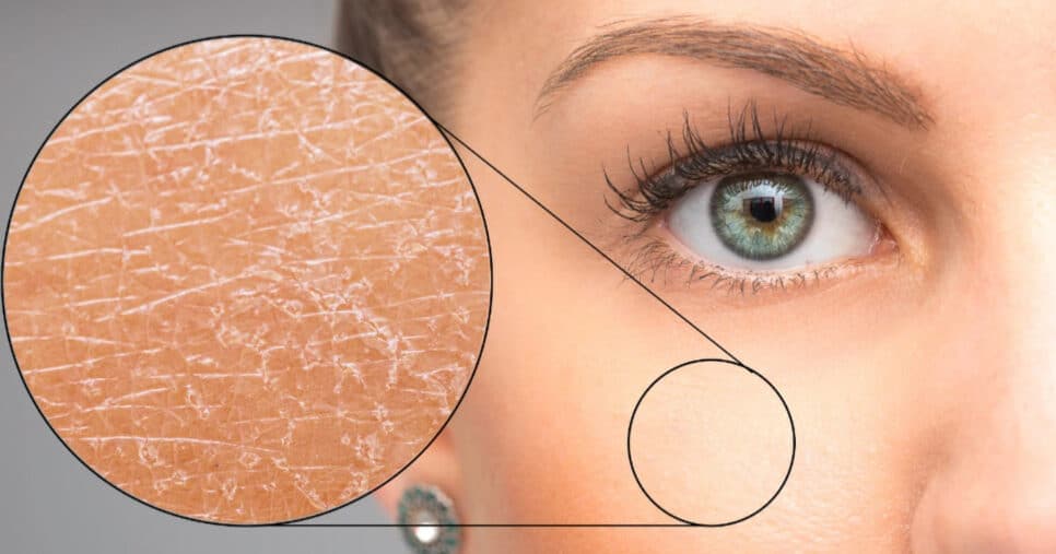 Óleo natural acaba com a pele ressecada das mulheres 40+ e faz hidratação profunda