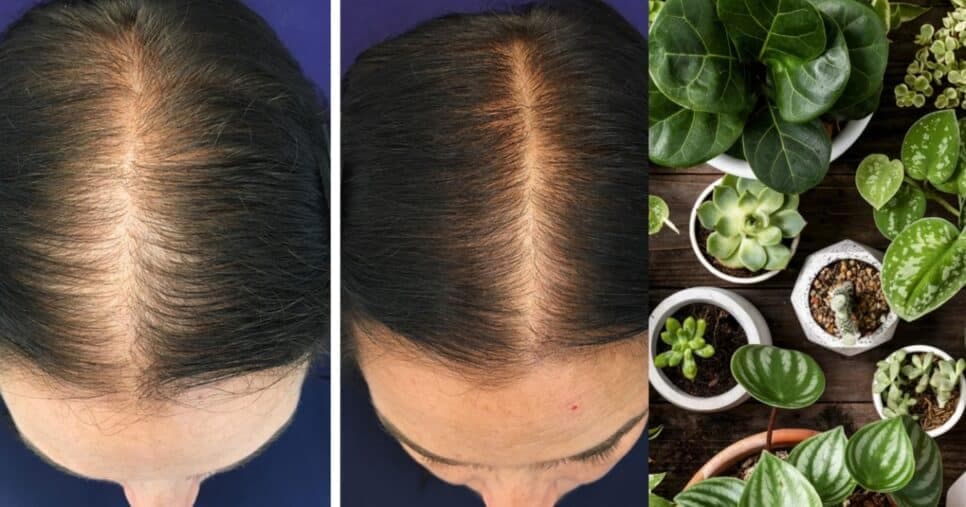 Cabelo 10cm maiores: 2 plantas milagrosas para acelerar o crescimento dos fios saudáveis e evitar a queda