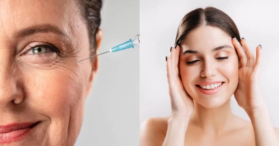 Tchau, rugas: Botox caseiro com apenas 3 ingredientes rejuvenesce às 50+ em até 20 anos