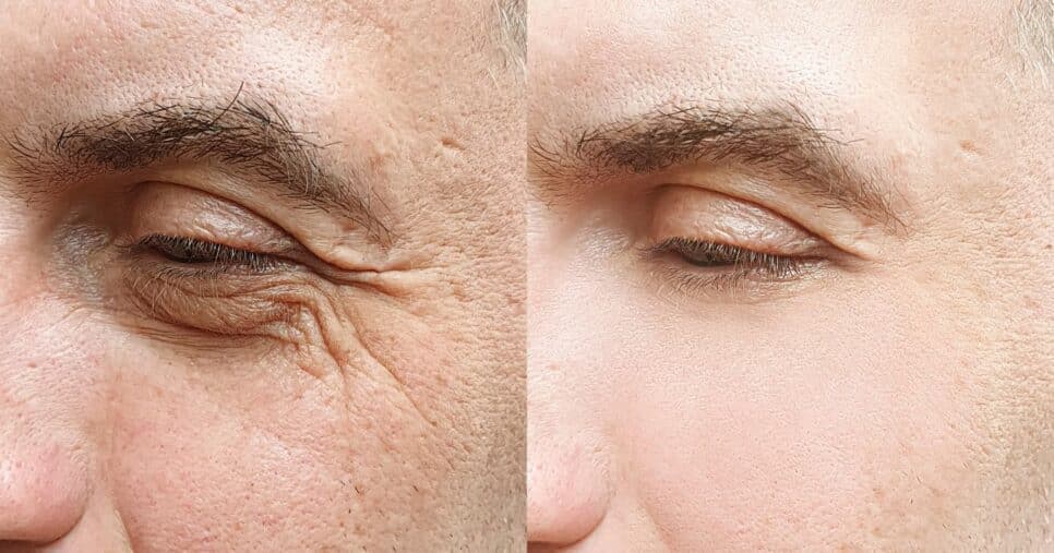 Rejuvenesça anos: Receita natural traz pele de seda, sem manchas e rugas