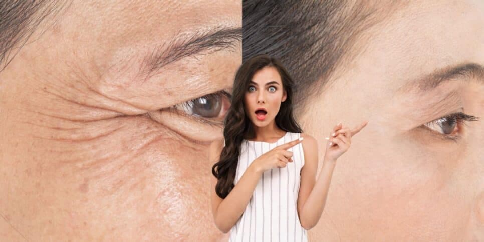 Fim do botox: Receita com 1 ingrediente caseiro elimina as rugas e paralisa o envelhecimento