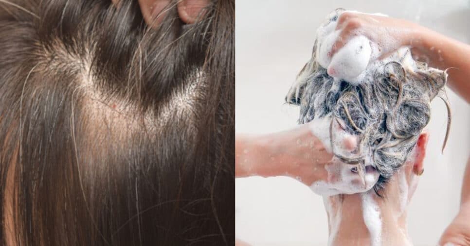 Tchau, grisalho: Shampoo caseiro de café e +4 ingredientes cobre até a raiz dos fios brancos das 60+