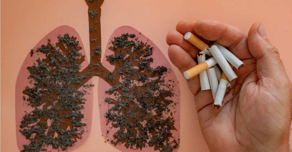 Câncer de pulmão e cigarro (Foto: Reprodução/ Internet)