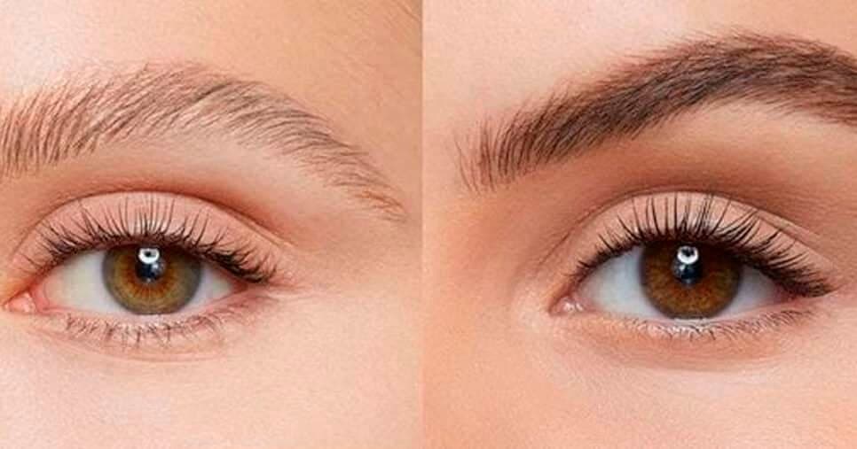 Antes e depois de uma sobrancelha (Foto: Reprodução)