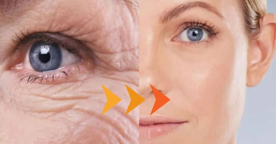Melhor que botox às 60+: Mistura natural com 3 ingredientes acaba de vez com as rugas e manchas