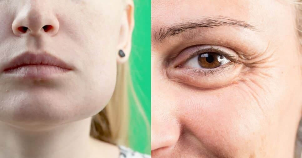 Emagrecem 5kg: Peeling caseiro com 2 ingredientes afina o rosto inchado e suga rugas de dentro para fora