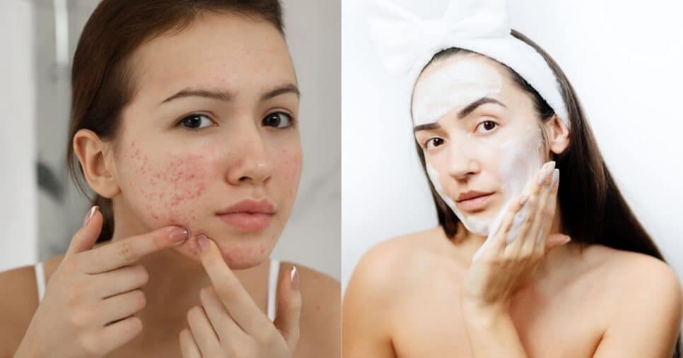 Tchau, manchas, acnes e rachaduras: Sabonete caseiro com 3 ingredientes deixa pele hidratada e radiante
