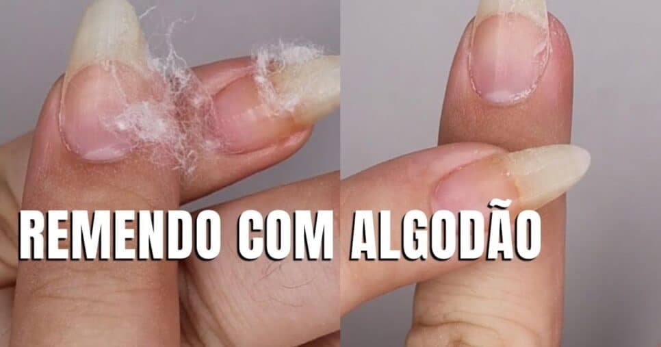 Remendo com algodão (Reprodução/Youtube)