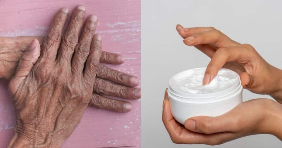 Elixir rejuvenescedor: Clareamento natural com 4 ingredientes suga rugas e ressecamento das mãos