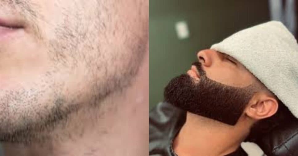 Barbeiros escondem: Mistura com 2 ingredientes dá fim as falhas na barba e deixa homens 45+ irresistíveis
