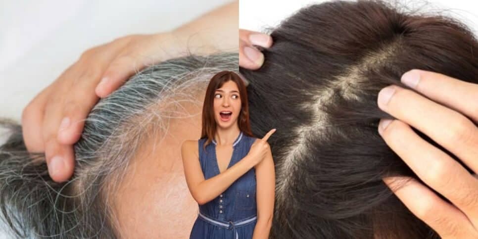 Matizador caseiro com ingrediente n°1 de cozinha elimina o cabelo branco em 2 passos