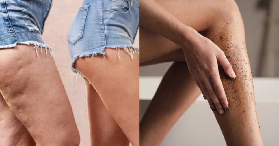 Fim da celulite: Esfoliante caseiro com 4 ingrediente deixa pele lisinha e sem imperfeições em 2 passos