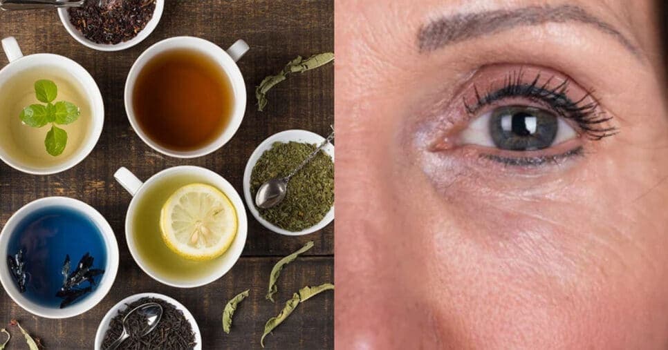 Tchau, rugas: 3 receitas caseiras para rejuvenescer qualquer mulher em 2025