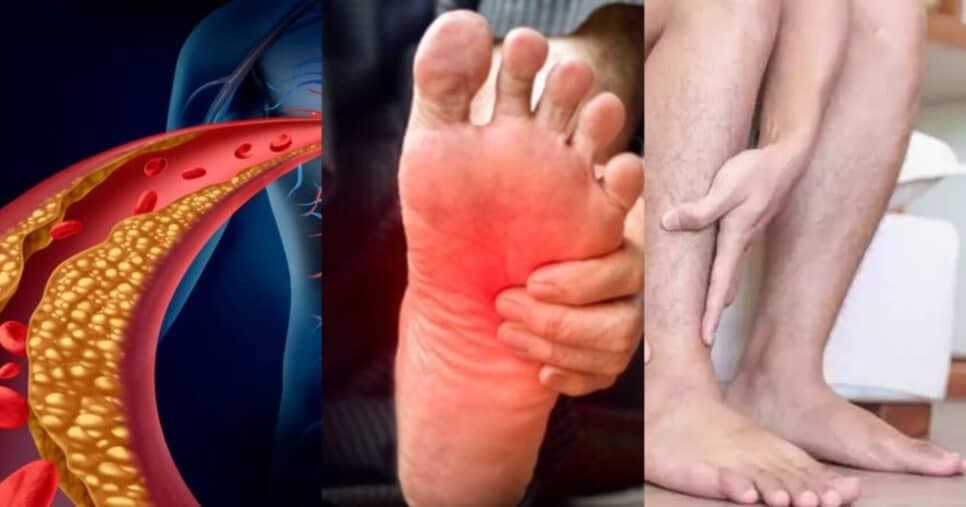 Alerta de gordura disparada no sangue: 5 sinais silenciosos nos pés que indicam colesterol nas alturas nos 50+