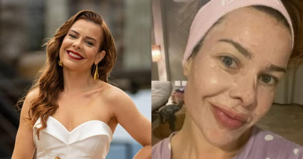 Botox de graça: Esfoliante caseiro de Fernanda Souza com mel +1 ingrediente suga rugas e manchas