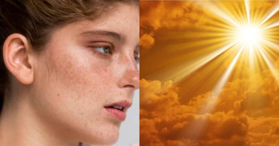 Rostinho de 20 eternamente: Tônico facial caseiro com 3 ingredientes remove manchas solares do dia para noite