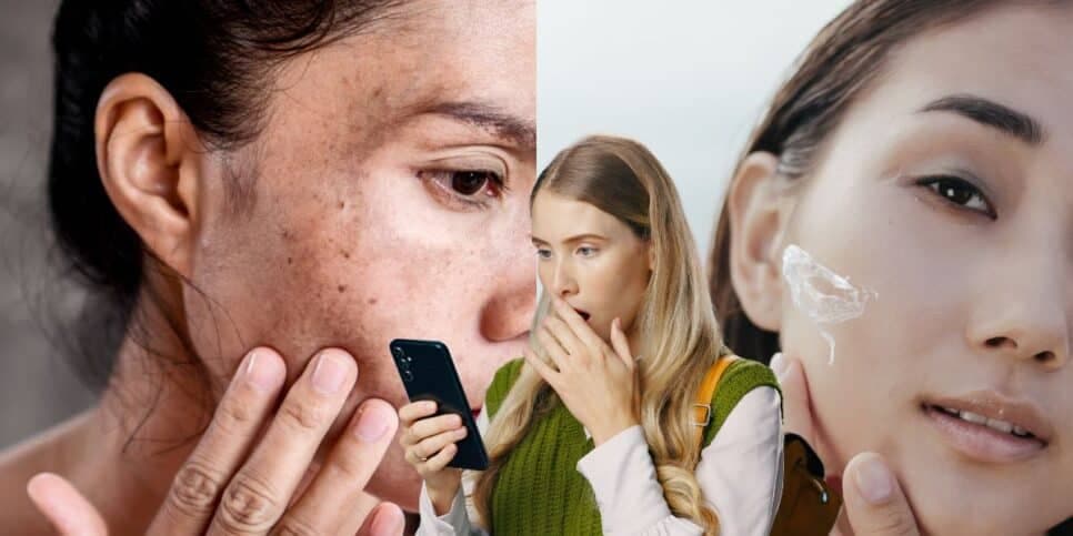 Adeus, manchas: Mulheres 50+ em festa com 1 único ingrediente que clareia a pele em minutos