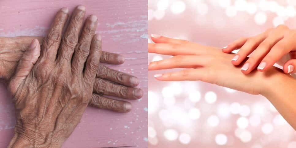 Adeus, manchas e rugas: 2 receitas naturais para mulheres 60+ ter mãos jovens em minutos