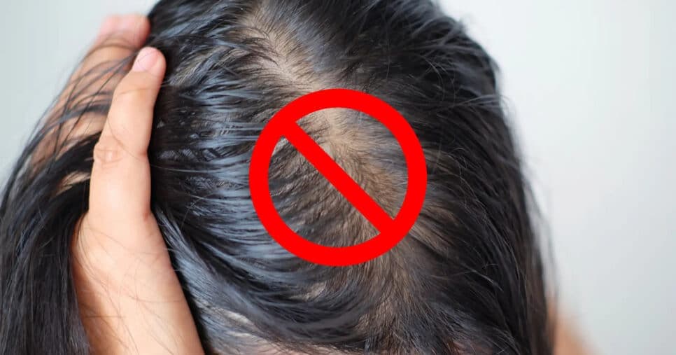 Fim do cabelo oleoso mesmo sem lavar: 5 ingredientes mágicos trazem o aspecto de limpo aos fios em 10 minutos