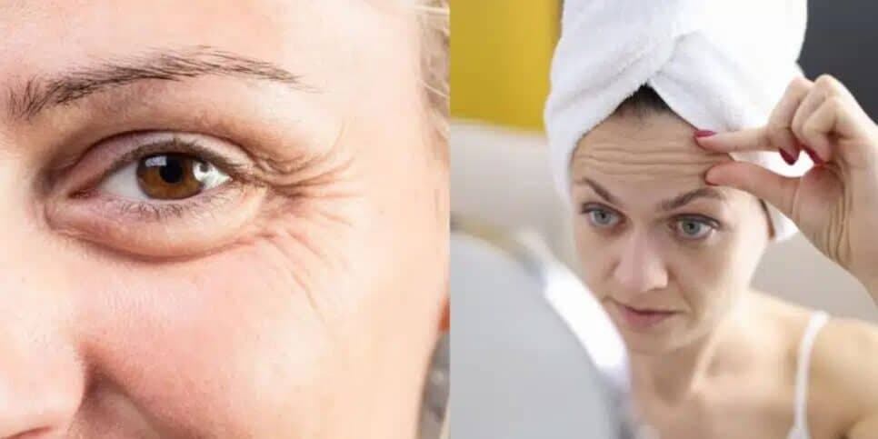 Tchau, rugas: Misturinha com 5 ingredientes elimina terror das idosas 60+ e traz pele de porcelana em 2025
