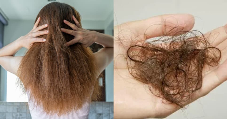 Tchau, queda de cabelo: 3 truques infalíveis vão ressuscitar o seu cabelo em 2025
