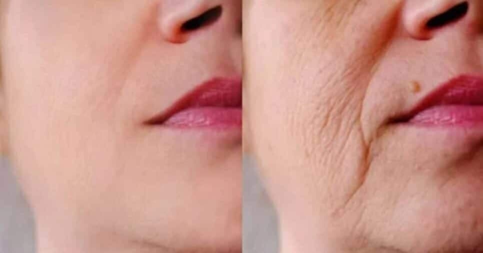 1 único ingrediente é capaz de reduzir rugas profundas e rejuvenescer mulheres 40+ - Foto: Internet