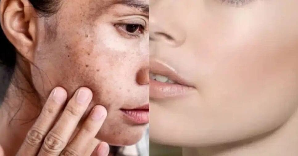 Milagre da juventude: Mistura natural com 2 ingredientes some com rugas e deixa pele lisinha igual ao botox
