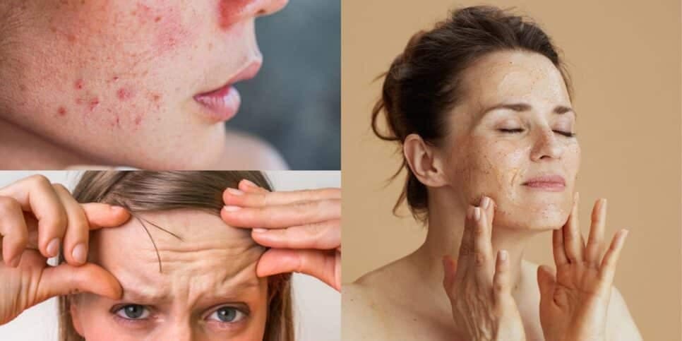 Adeus, rugas e cravos: Botox caseiro com 3 ingredientes naturais rejuvenesce as mulheres 50+