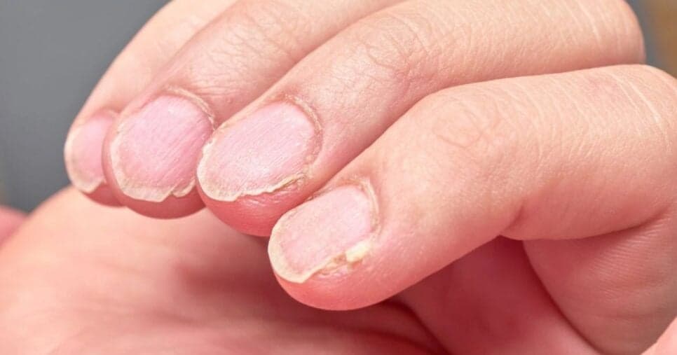 Nem o melhor salão vai salvar: 5 hábitos comuns triplicam a quebra das unhas e mulheres devem banir agora