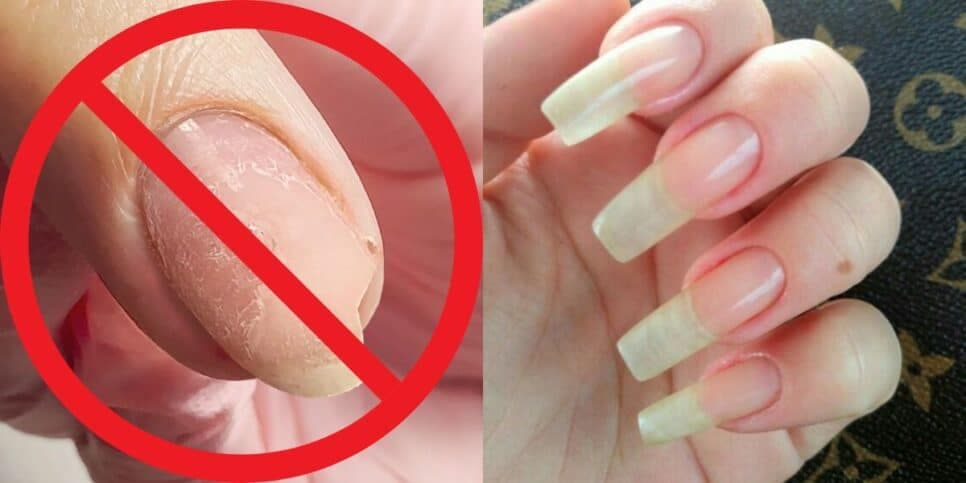 Adeus, salão de beleza: Receita natural com 4 ingredientes garante unhas longas e inquebráveis